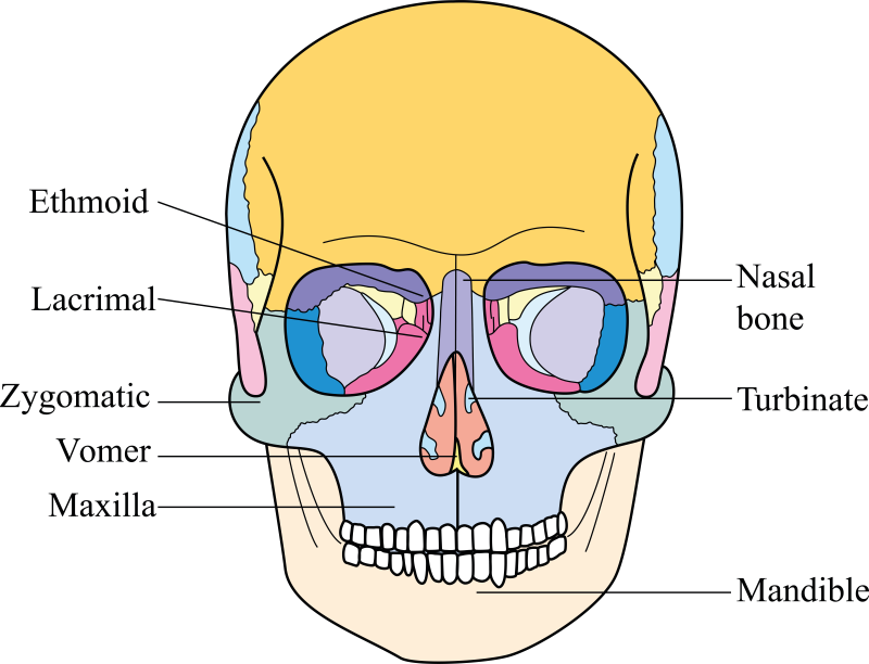 facial fracture