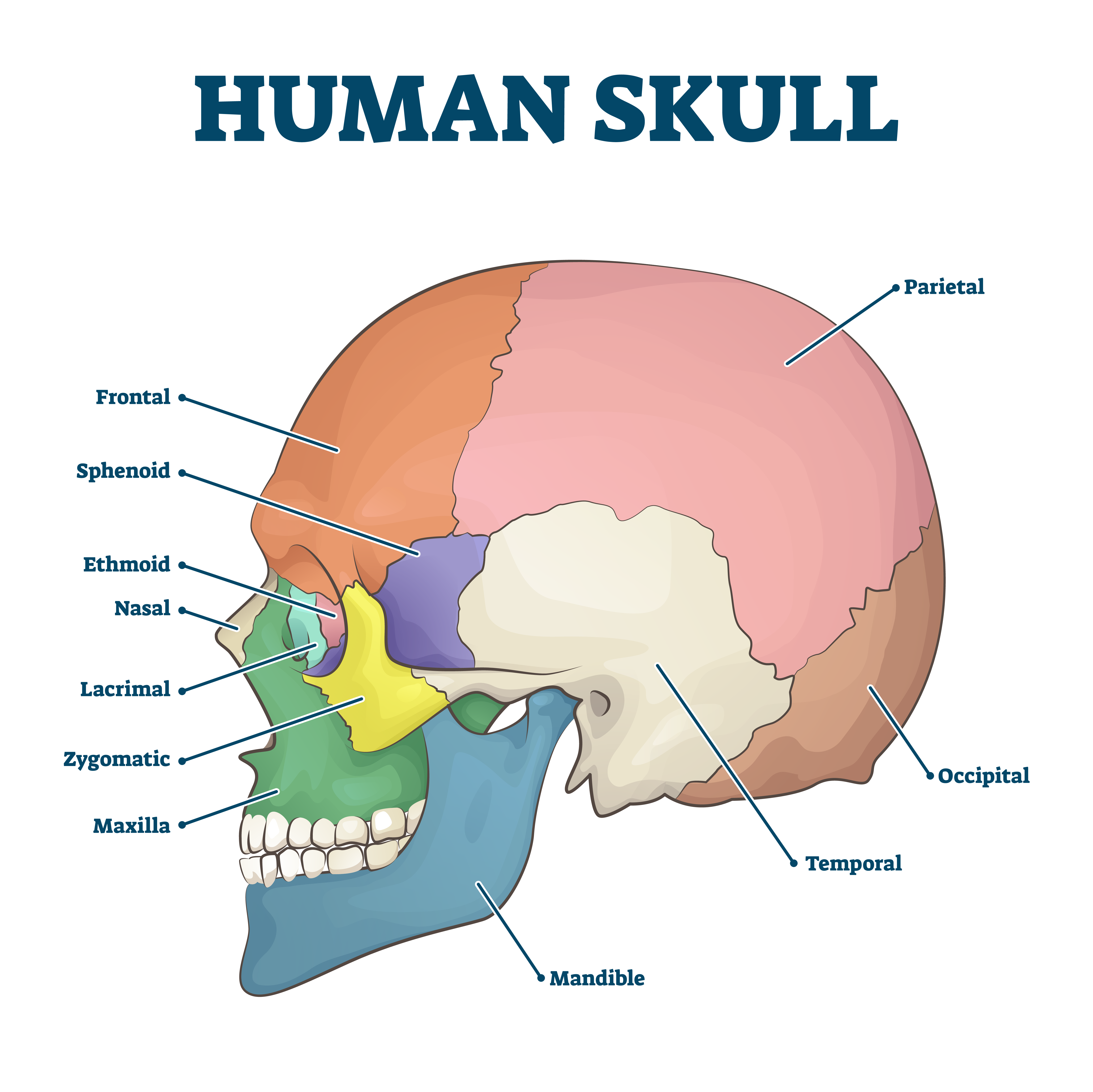 skull fracture